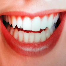 Ästhetische Zahnheilkunde